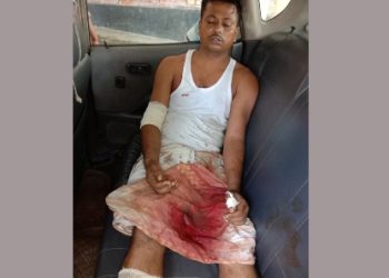 বন্দরে ইন্স্যুরেন্স কোম্পানীর ম্যানেজারকে কুপিয়ে টাকা ও স্বর্ণালংকার লুট