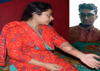 যৌতুকের জন্য স্ত্রীকে ঝলসে দিয়েছে স্বামী