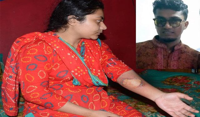 যৌতুকের জন্য স্ত্রীকে ঝলসে দিয়েছে স্বামী