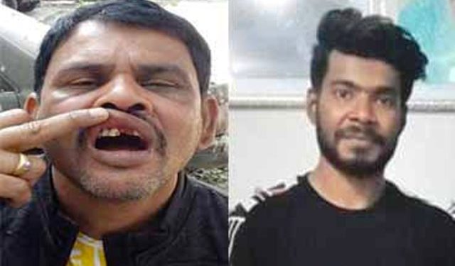 বাস কন্ট্রাকটারের দাঁত কর্তনের ঘটনায় বন্দরে ছাত্রলীগ নেতা সুস্মিতের বিরুদ্ধে মামলা