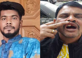 মহানগর ছাত্রলীগ নেতা সুস্মিতের সন্ত্রাসী হামলায় কন্ট্রাকটার আবুল আহত