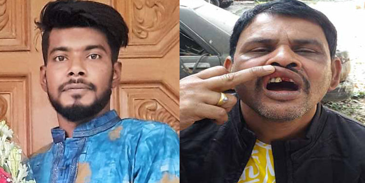 মহানগর ছাত্রলীগ নেতা সুস্মিতের সন্ত্রাসী হামলায় কন্ট্রাকটার আবুল আহত