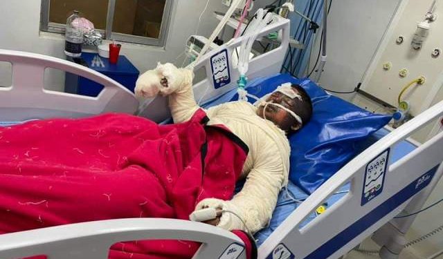 ফতুল্লায় গ্যাস লিকেজের আগুনে দগ্ধ মৃতের সংখ্যা বেড়ে ৪