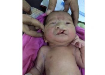 ৪দিনের শিশুর জীবন বাঁচাতে মানবিক আবেদন