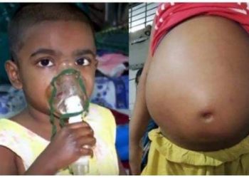 বাঁচতে চায় শিশু ওমর ফারুক