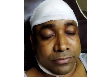 রূপগঞ্জে সাংবাদিক রিয়াজের উপর সন্ত্রাসী হামলা