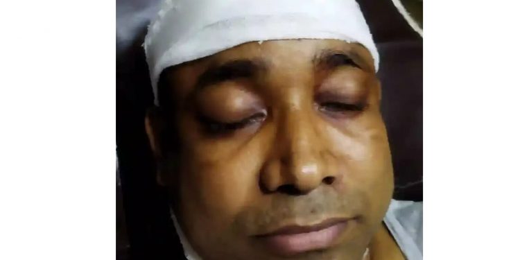 রূপগঞ্জে সাংবাদিক রিয়াজের উপর সন্ত্রাসী হামলা
