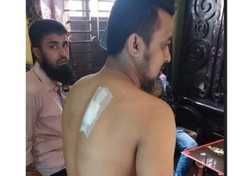 রূপগঞ্জে গার্মেন্টস শ্রমিককে কুপিয়ে মোবাইল নগদ টাকা ছিনতাই