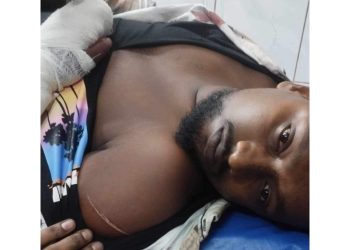 বন্দরে মাদক ব্যবসায় বাধা দেওয়ায় যুবককে কুপিয়ে আহত