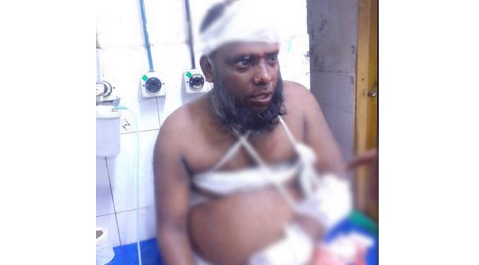 বন্দরে ইসলামী আন্দোলনের নেতা ডা.মামুনকে কু/পি/য়ে আহত